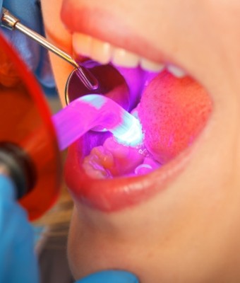 Close up of a dental patient receiving cosmetic dental bonding