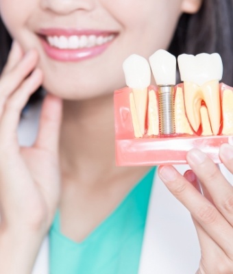 Dentist holding a model of a dental implant in the jaw